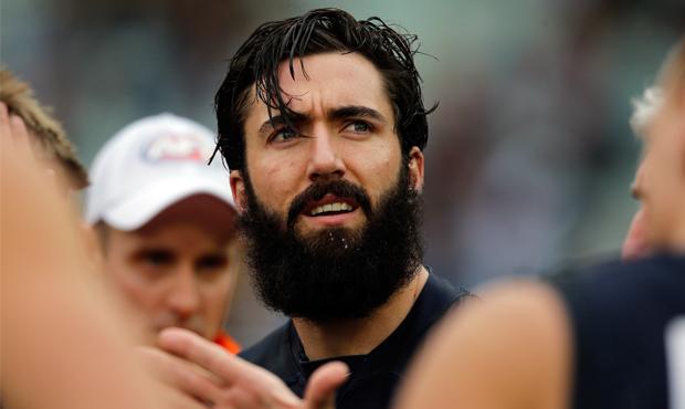 SimpsonBeardBeastArticle_620X370.jpg